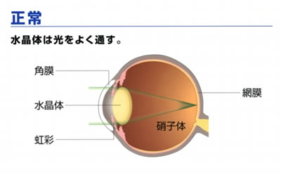 正常