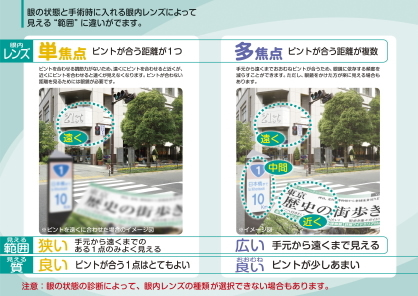 単焦点と多焦点、乱視